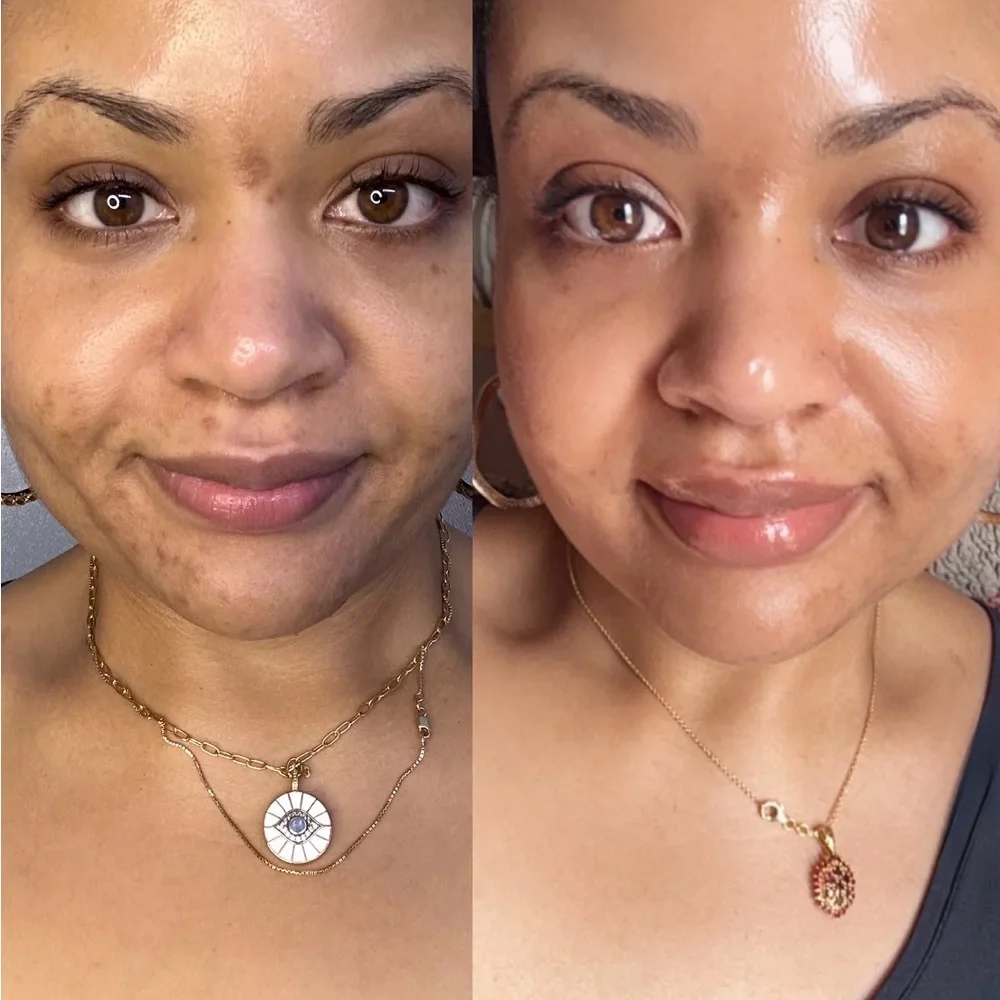Byroe Celery AHA + LHA Serum - Picture 4 of 7